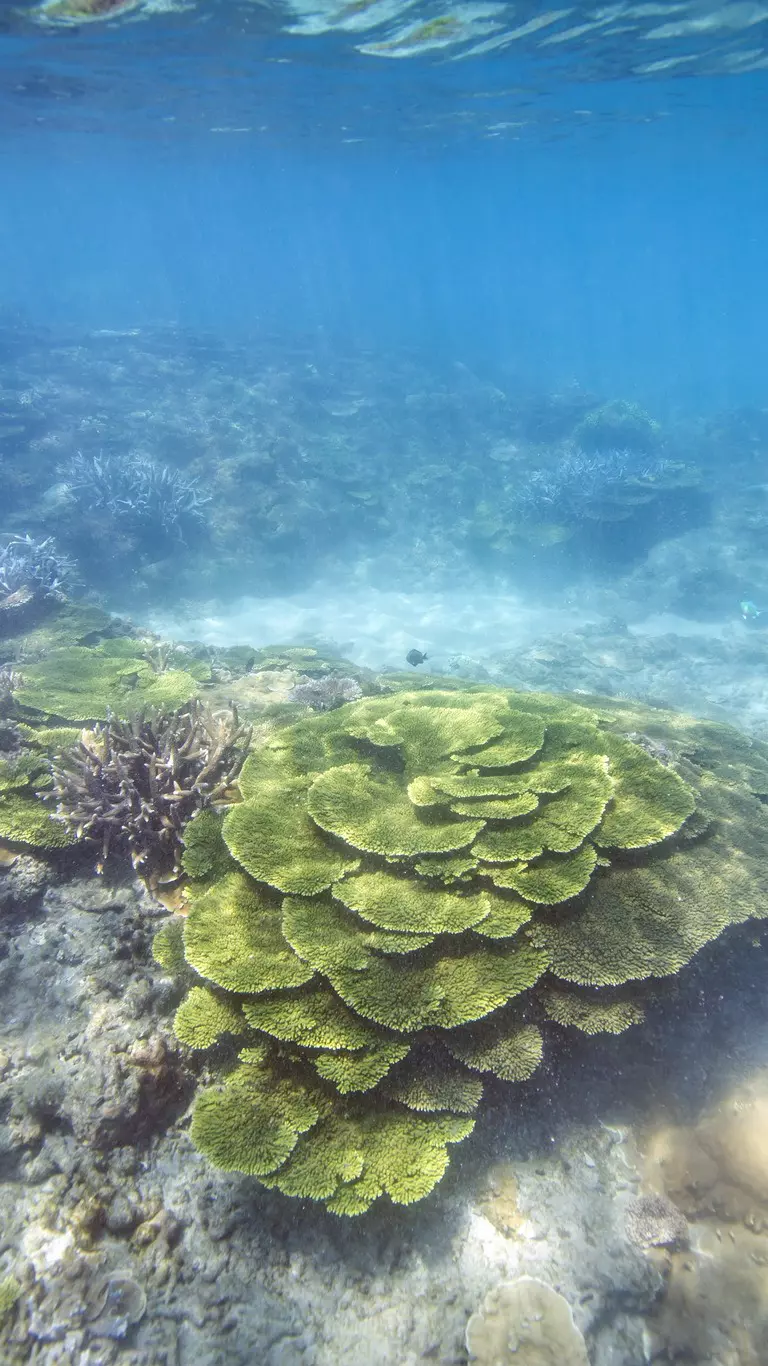 Nouveautés de CARIS Mira AI